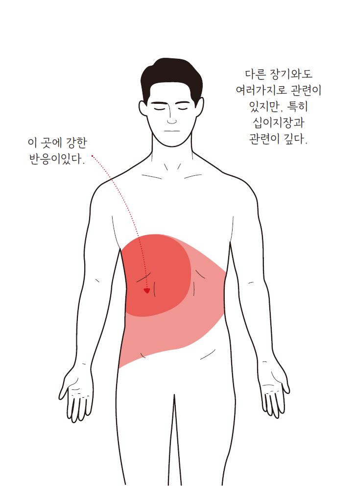 간암