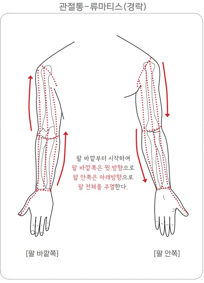 류마티스
