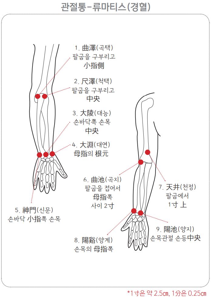류마티스