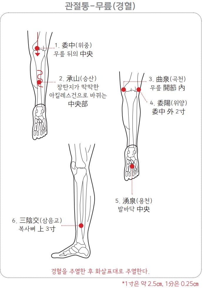 무릎