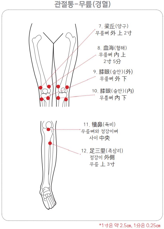 무릎