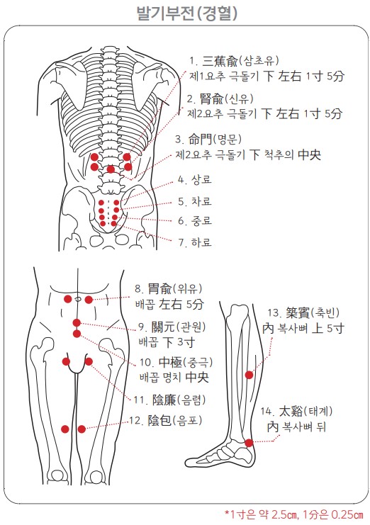 요통