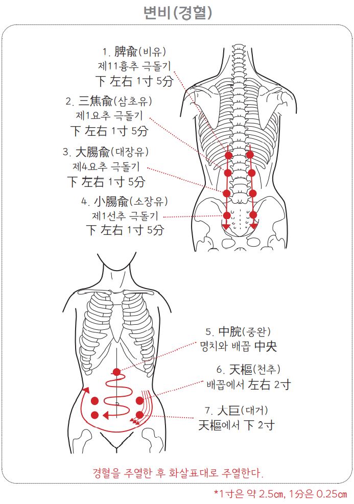 변비