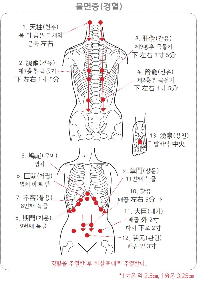 불면증