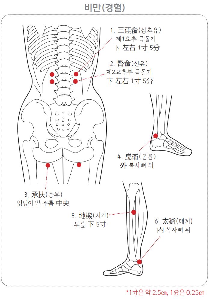 비만