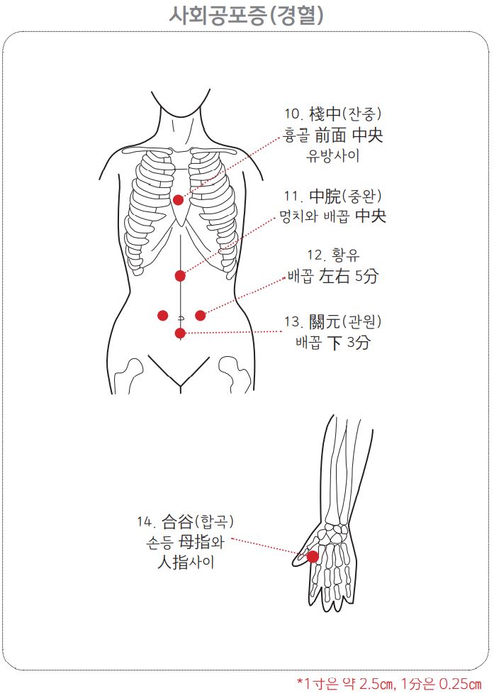 사회공포증