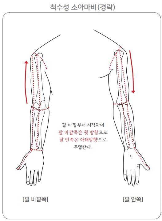소아마비