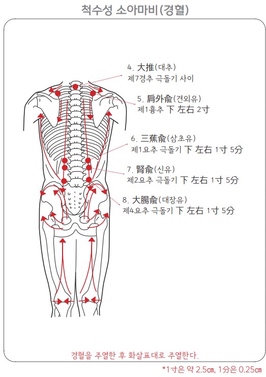 소아마비