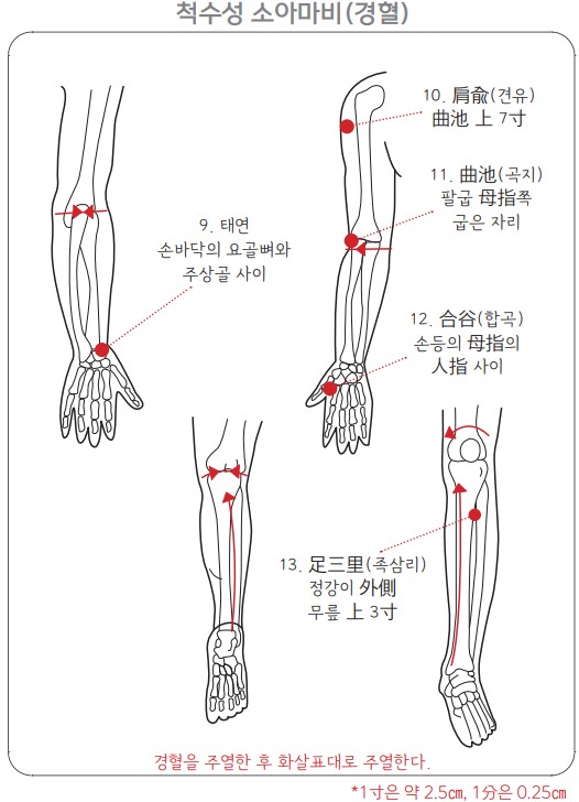 소아마비