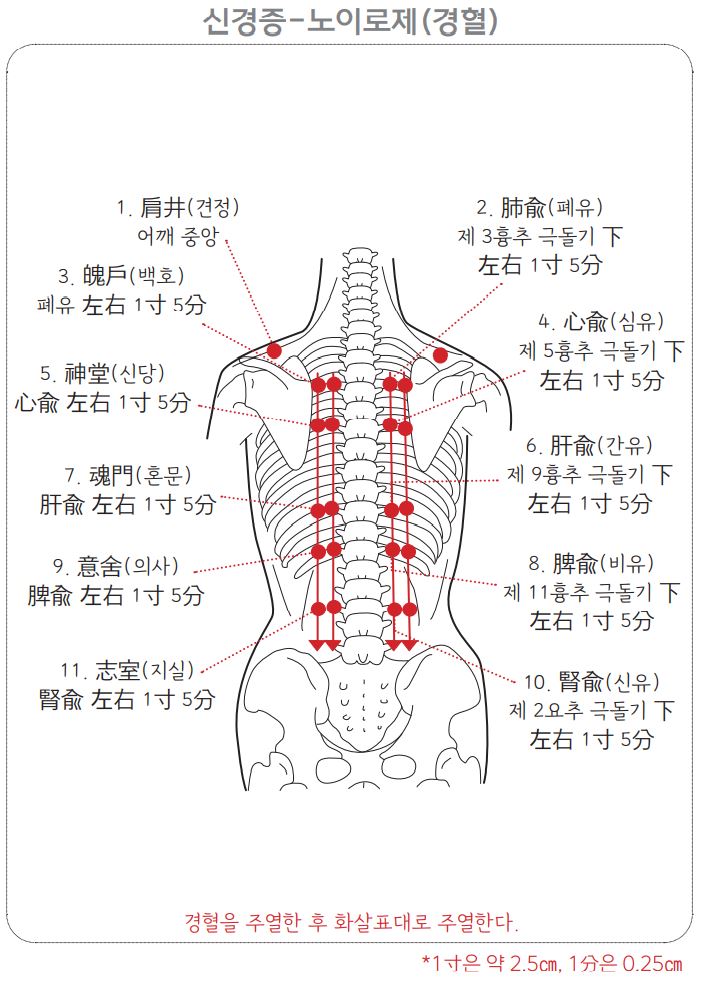 신경증