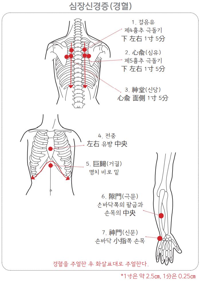 심장신경증