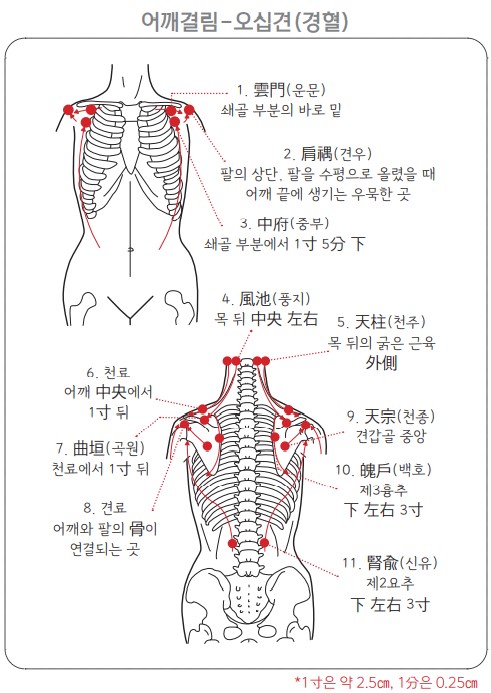 어깨결림