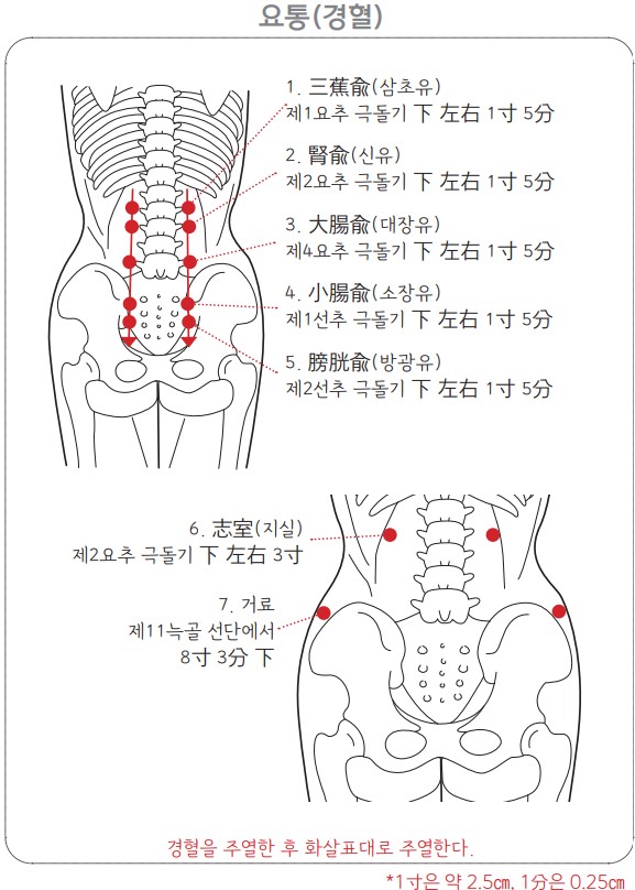 요통