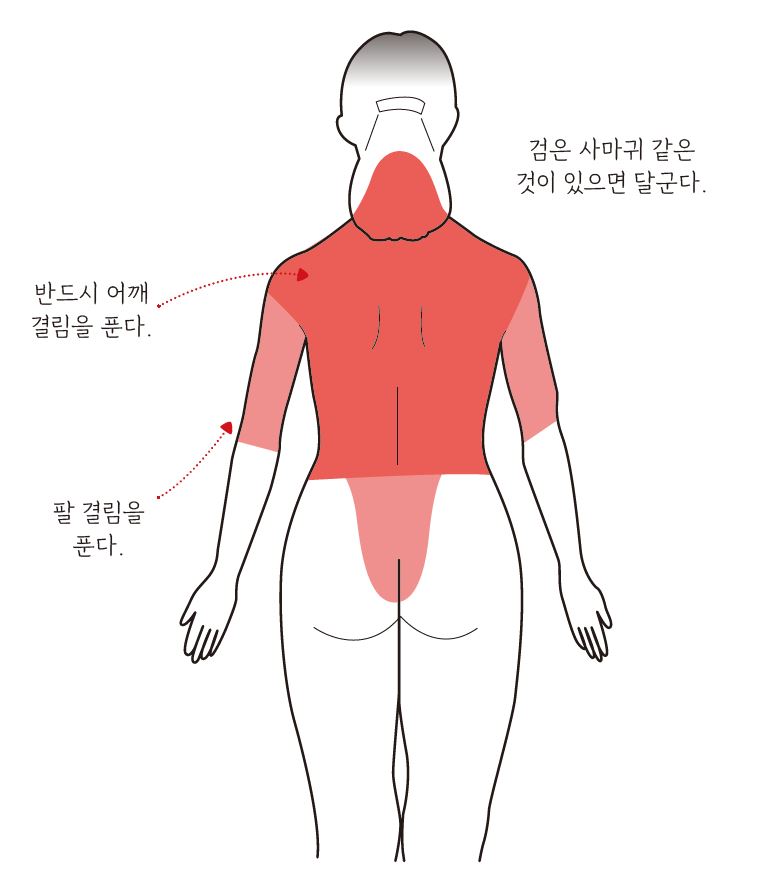유방암