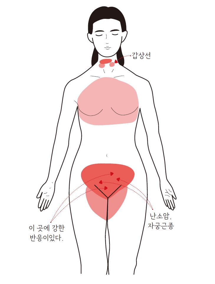자궁