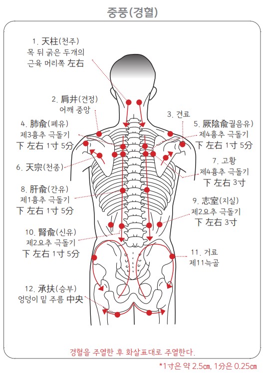 중풍