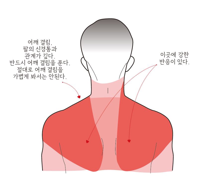 폐암